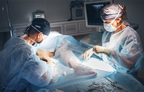Cirugia vascular varices